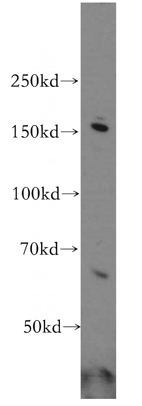 HeLa cells were subjected to SDS PAGE followed by western blot with Catalog No:111137(GPRASP1-Specific antibody) at dilution of 1:500