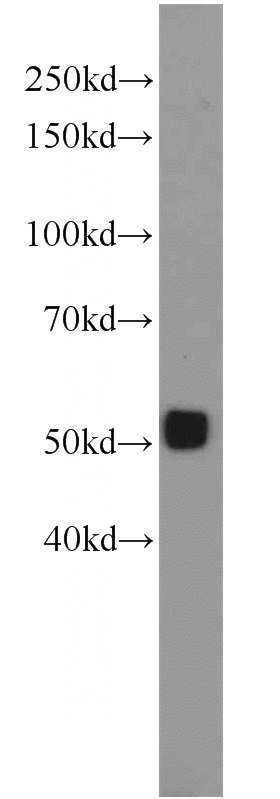 mouse ovary tissue were subjected to SDS PAGE followed by western blot with Catalog No:117195(BMP15 antibody) at dilution of 1:300