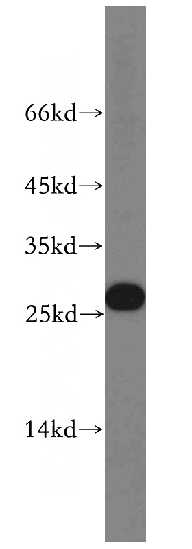 HepG2 cells were subjected to SDS PAGE followed by western blot with Catalog No:112910(MXD1 antibody) at dilution of 1:500