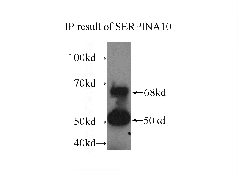 IP Result of anti-SERPINA10 (IP:Catalog No:115196, 3ug; Detection:Catalog No:115196 1:1000) with L02 cells lysate 2500ug.