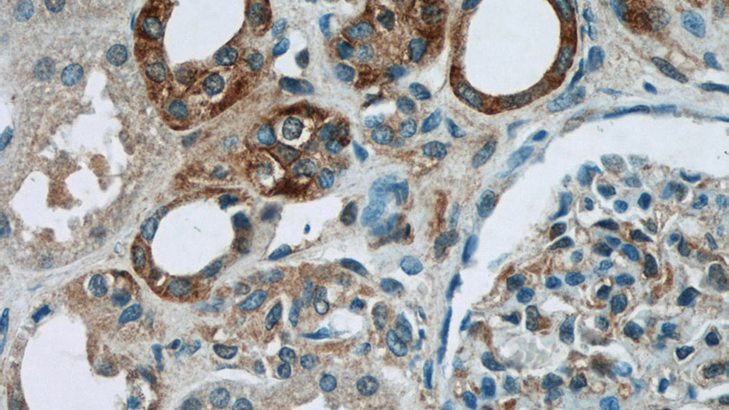 Immunohistochemistry of paraffin-embedded human kidney tissue slide using Catalog No:113832(CSDC2 Antibody) at dilution of 1:50 (under 40x lens)
