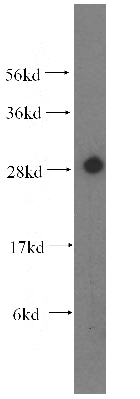 mouse ovary tissue were subjected to SDS PAGE followed by western blot with Catalog No:108747(CA2 antibody) at dilution of 1:500