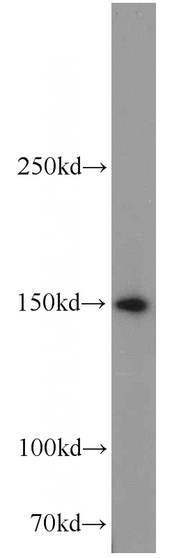 HeLa cells were subjected to SDS PAGE followed by western blot with Catalog No:115054(SAMD9 antibody) at dilution of 1:1000