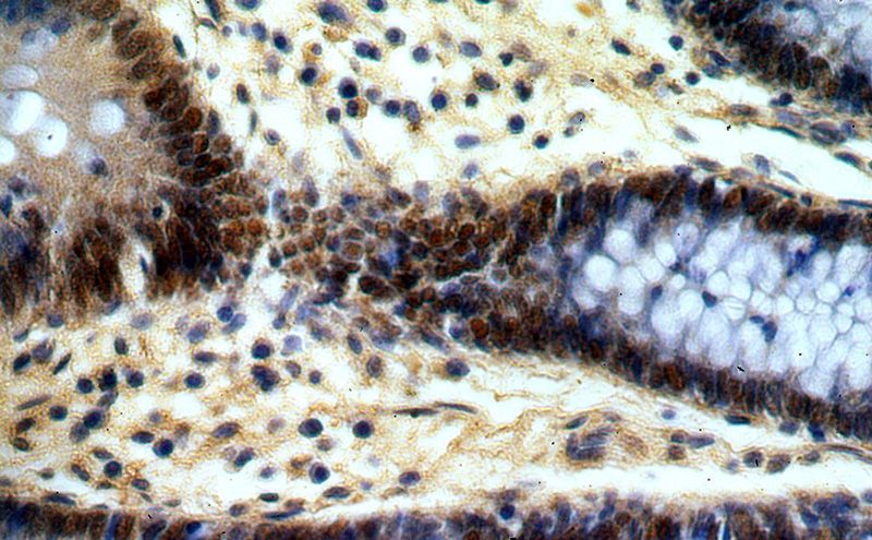 Immunohistochemical of paraffin-embedded human colon using Catalog No:114191(PRICKLE3 antibody) at dilution of 1:50 (under 40x lens)