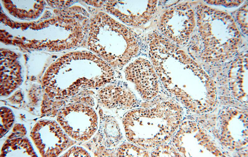 Immunohistochemical of paraffin-embedded human testis using Catalog No:108028(APOBEC4 antibody) at dilution of 1:50 (under 10x lens)