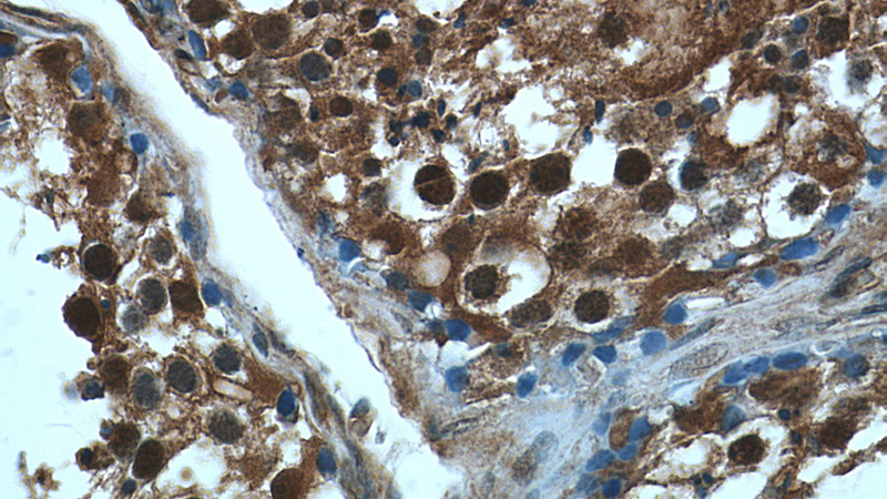 Immunohistochemistry of paraffin-embedded human testis tissue slide using Catalog No:116423(TSC22D1 Antibody) at dilution of 1:50 (under 40x lens)