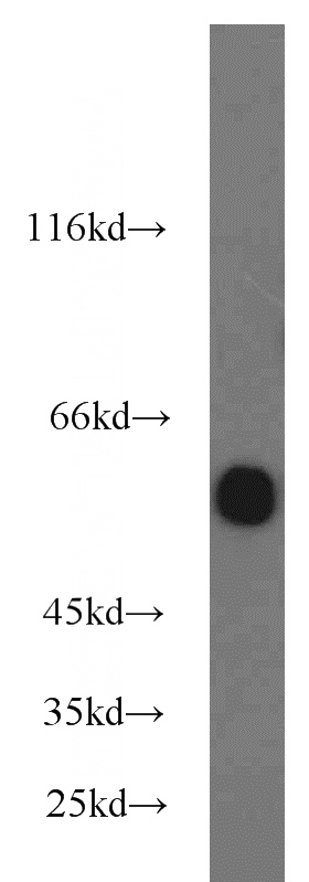 COLO 320 cells were subjected to SDS PAGE followed by western blot with Catalog No:110309(EED antibody) at dilution of 1:1000