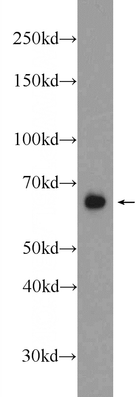 rat brain tissue were subjected to SDS PAGE followed by western blot with Catalog No:113798(PHACTR1 Antibody) at dilution of 1:2000