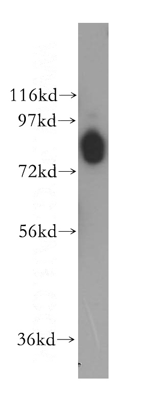 mouse brain tissue were subjected to SDS PAGE followed by western blot with Catalog No:109373(COL4A3BP antibody) at dilution of 1:200