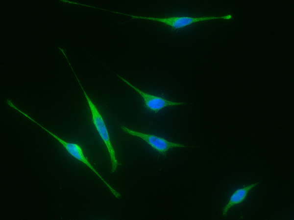 IL-6R / CD126 Antibody, Mouse MAb, Immunofluorescence