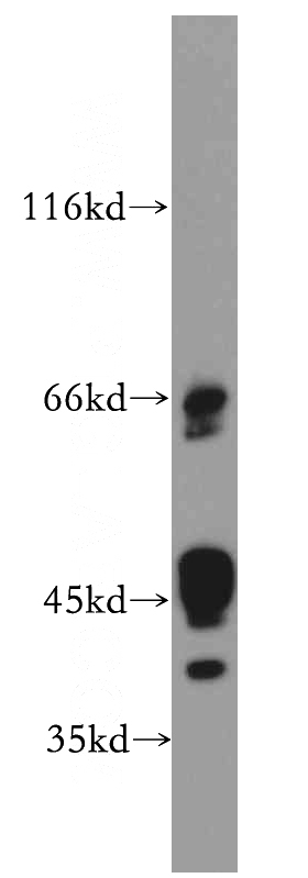 MCF7 cells were subjected to SDS PAGE followed by western blot with Catalog No:111776(IL20RB antibody) at dilution of 1:500