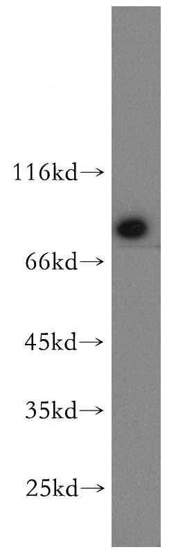 Jurkat cells were subjected to SDS PAGE followed by western blot with Catalog No:110906(GCLC antibody) at dilution of 1:200