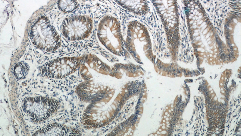 Immunohistochemical of paraffin-embedded human colon using Catalog No:115915(TCP1 antibody) at dilution of 1:50 (under 10x lens)
