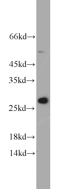 HEK-293 cells were subjected to SDS PAGE followed by western blot with Catalog No:112510(MESDC2 antibody) at dilution of 1:200