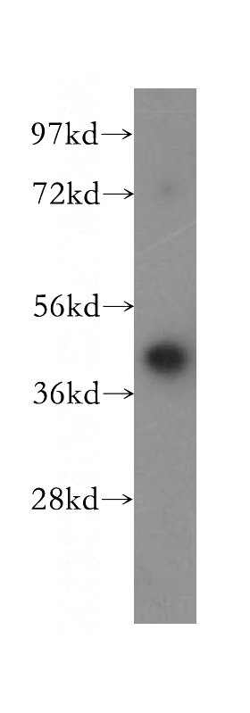 Jurkat cells were subjected to SDS PAGE followed by western blot with Catalog No:116834(WNT2 antibody) at dilution of 1:300