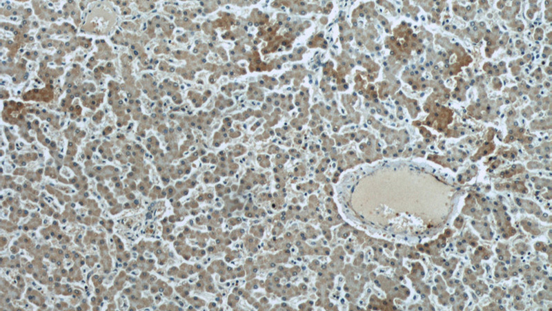 Immunohistochemical of paraffin-embedded human liver using Catalog No:107199(F12 antibody) at dilution of 1:50 (under 10x lens)