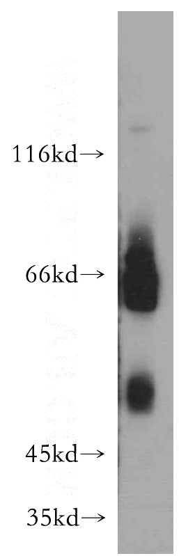 HEK-293 cells were subjected to SDS PAGE followed by western blot with Catalog No:109027(CD320 antibody) at dilution of 1:500