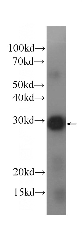 Recombinant protein were subjected to SDS PAGE followed by western blot with Catalog No:107379(IL12A Antibody) at dilution of 1:2000