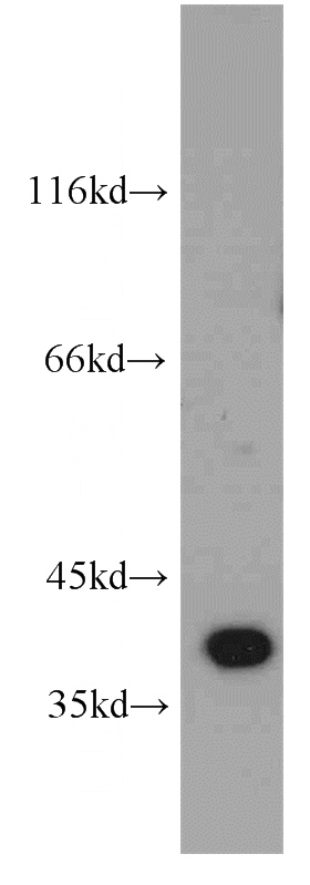 Y79 cells were subjected to SDS PAGE followed by western blot with Catalog No:110231(ELOVL4 antibody) at dilution of 1:500