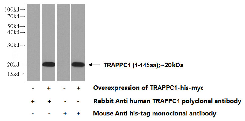 Transfected HEK-293 cells were subjected to SDS PAGE followed by western blot with Catalog No:116341(TRAPPC1 Antibody) at dilution of 1:1000