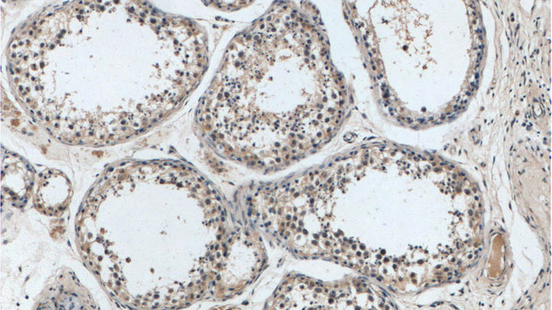 Immunohistochemistry of paraffin-embedded human testis tissue slide using Catalog No:108645(C11orf79 Antibody) at dilution of 1:50 (under 10x lens)