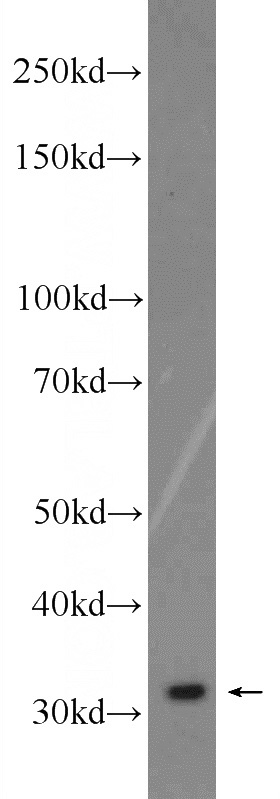 HeLa cells were subjected to SDS PAGE followed by western blot with Catalog No:114052(POLR3G Antibody) at dilution of 1:1000