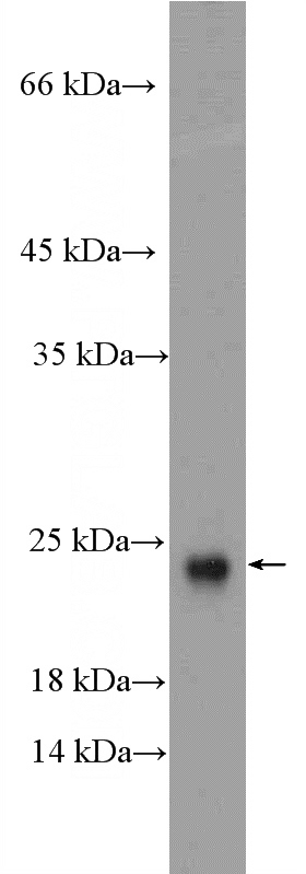 A549 cells were subjected to SDS PAGE followed by western blot with Catalog No:108199(ARL2BP Antibody) at dilution of 1:300
