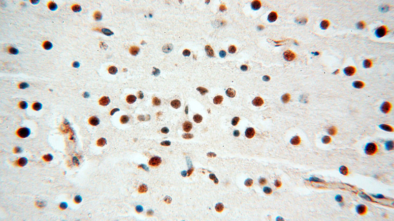Immunohistochemical of paraffin-embedded human brain using Catalog No:112366(MAD1L1 antibody) at dilution of 1:100 (under 40x lens)