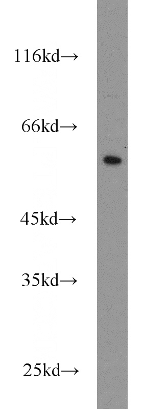 human placenta tissue were subjected to SDS PAGE followed by western blot with Catalog No:109707(CYP4F12 antibody) at dilution of 1:500