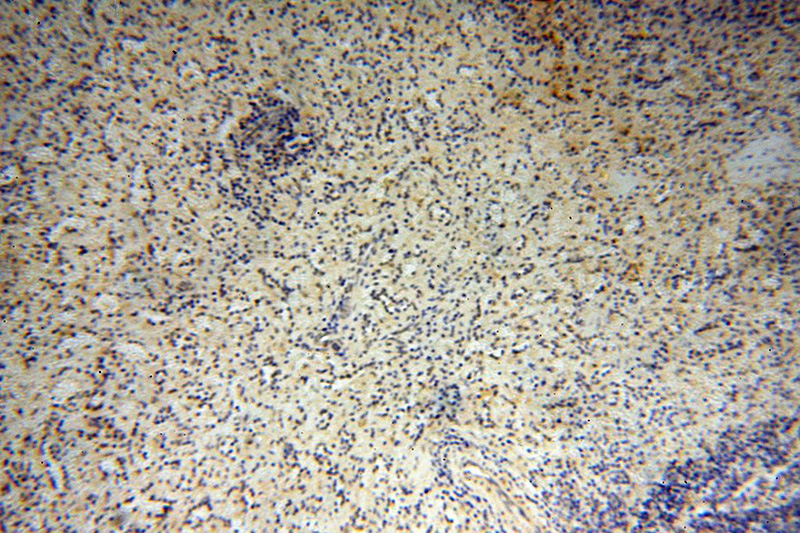 Immunohistochemical of paraffin-embedded human spleen using Catalog No:110355(ERG antibody) at dilution of 1:25 (under 10x lens)