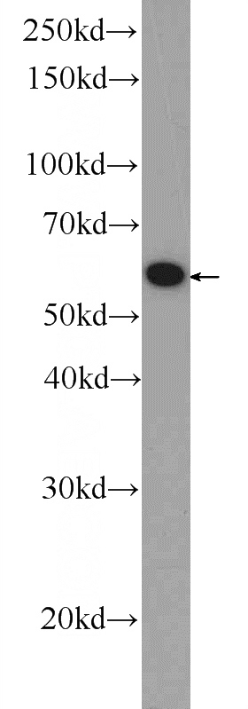 mouse cerebellum tissue were subjected to SDS PAGE followed by western blot with Catalog No:115399(SMPD1,ASM Antibody) at dilution of 1:300