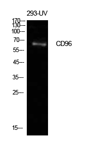 Fig1:; Western Blot analysis of 293-UV cells using CD96 Polyclonal Antibody. Antibody was diluted at 1:500. Secondary antibody（catalog#: HA1001) was diluted at 1:20000