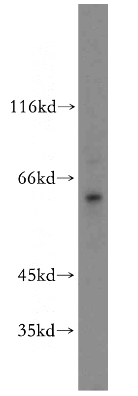 HeLa cells were subjected to SDS PAGE followed by western blot with Catalog No:115982(TAF1B antibody) at dilution of 1:400