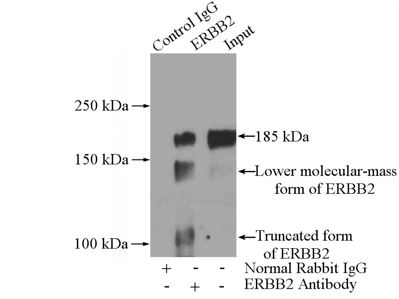 IP Result of anti-ERBB2,p185-Specific (IP:Catalog No:111295, 5ug; Detection:Catalog No:111295 1:500) with SGC-7901 cells lysate 2400ug.