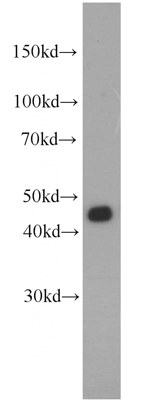 HeLa cells were subjected to SDS PAGE followed by western blot with Catalog No:110748(FUT6 antibody) at dilution of 1:1500