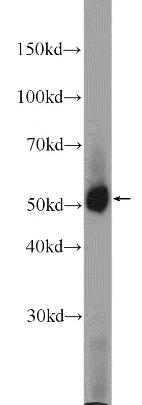 mouse liver tissue were subjected to SDS PAGE followed by western blot with Catalog No:113623(PDK1 Antibody) at dilution of 1:2000