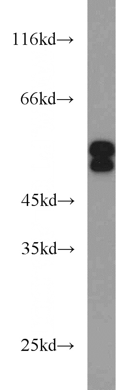 HeLa cells were subjected to SDS PAGE followed by western blot with Catalog No:115183(SH2D4A antibody) at dilution of 1:500