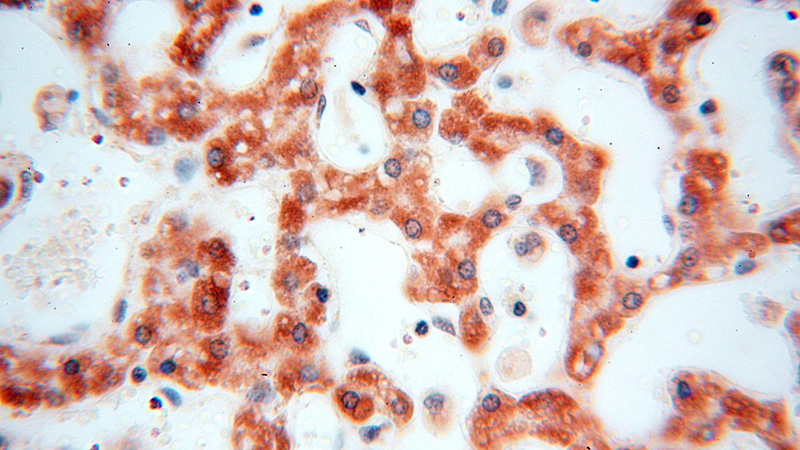 Immunohistochemical of paraffin-embedded human liver using Catalog No:113070(NDUFB10 antibody) at dilution of 1:50 (under 40x lens)