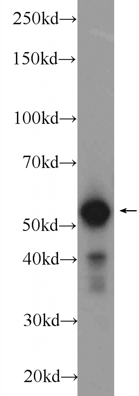 K-562 cells were subjected to SDS PAGE followed by western blot with Catalog No:109555(CREST Antibody) at dilution of 1:1000