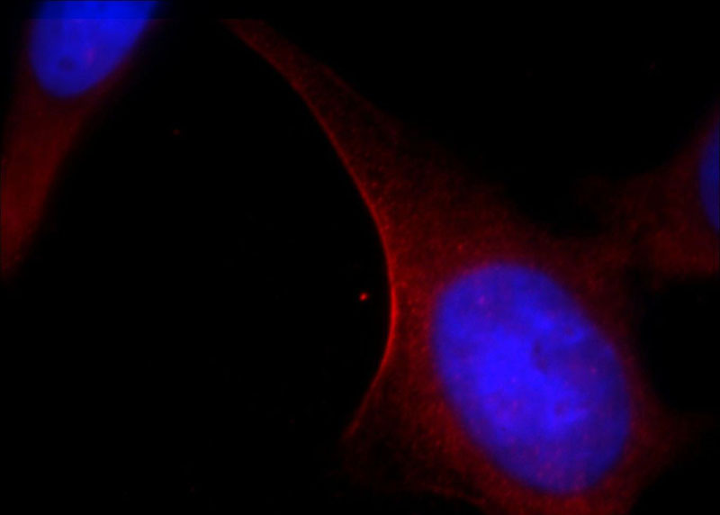 Immunofluorescent analysis of Hela cells, using MYH14 antibody Catalog No:112931 at 1:25 dilution and Rhodamine-labeled goat anti-rabbit IgG (red). Blue pseudocolor = DAPI (fluorescent DNA dye).