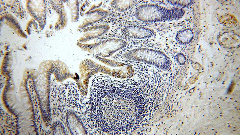 Immunohistochemical of paraffin-embedded human colon using Catalog No:112515(METT10D antibody) at dilution of 1:50 (under 10x lens)