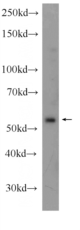 HeLa cells were subjected to SDS PAGE followed by western blot with Catalog No:112680(KIAA1804 Antibody) at dilution of 1:1000