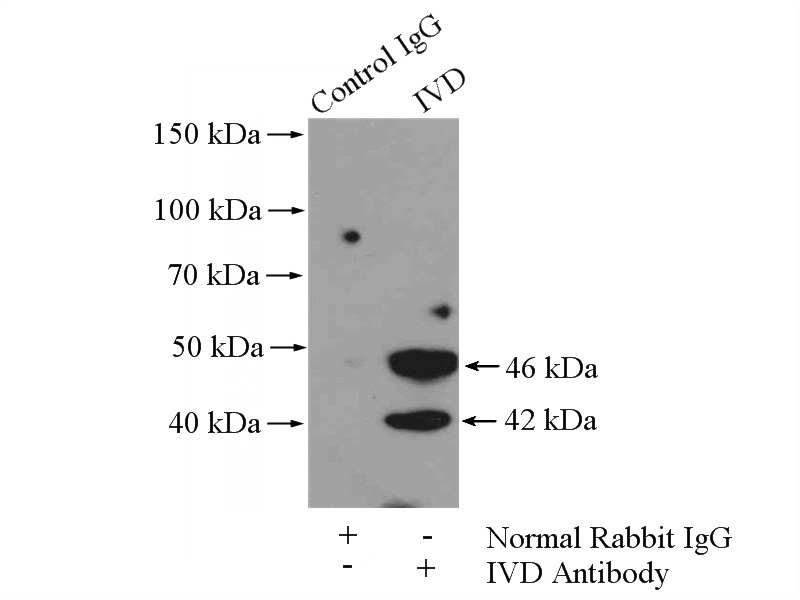 IP Result of anti-IVD (IP:Catalog No:111962, 4ug; Detection:Catalog No:111962 1:300) with MCF-7 cells lysate 800ug.