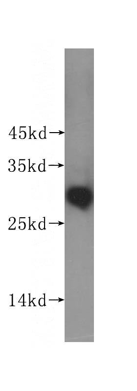 HeLa cells were subjected to SDS PAGE followed by western blot with Catalog No:112521(METTL6 antibody) at dilution of 1:300