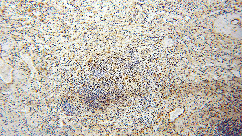 Immunohistochemical of paraffin-embedded human spleen using Catalog No:110507(EXOSC10 antibody) at dilution of 1:50 (under 10x lens)