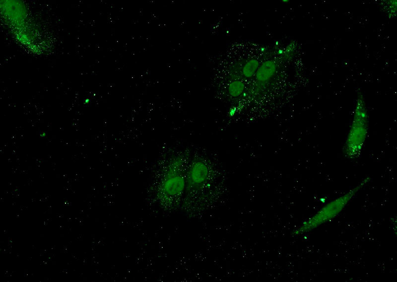 Immunofluorescent analysis of A549 cells using Catalog No:116896(YTHDF3 Antibody) at dilution of 1:50 and Alexa Fluor 488-congugated AffiniPure Goat Anti-Rabbit IgG(H+L)