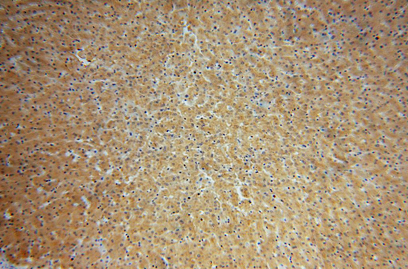Immunohistochemical of paraffin-embedded human liver using Catalog No:109602(CSNK1G1 antibody) at dilution of 1:100 (under 10x lens)