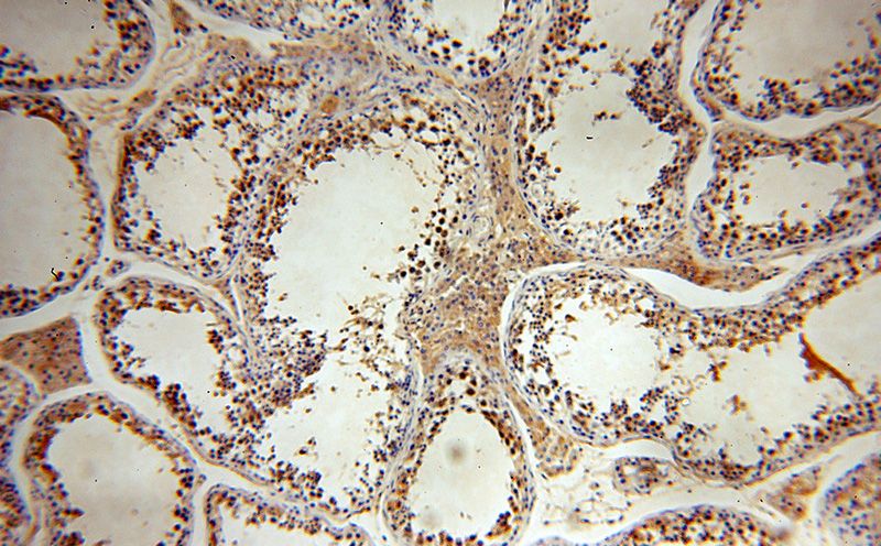 Immunohistochemical of paraffin-embedded human testis using Catalog No:115757(SYCE1 antibody) at dilution of 1:100 (under 10x lens)