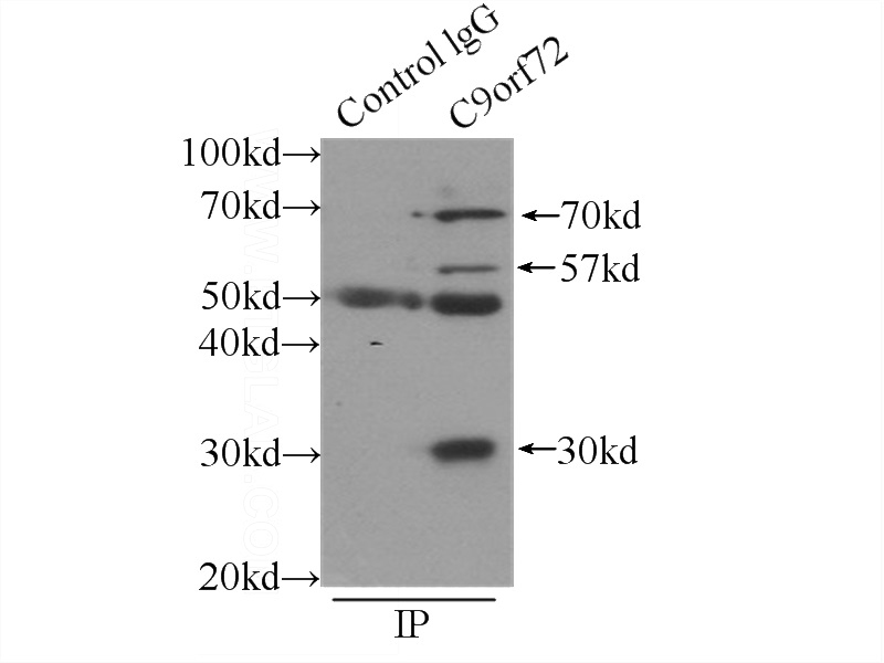 IP Result of anti-C9orf72 (IP:Catalog No:108803, 3ug; Detection:Catalog No:108803 1:300) with SH-SY5Y cells lysate 2000ug.