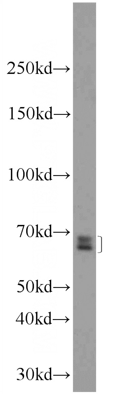 mouse spleen tissue were subjected to SDS PAGE followed by western blot with Catalog No:111057(GPATCH2 Antibody) at dilution of 1:600